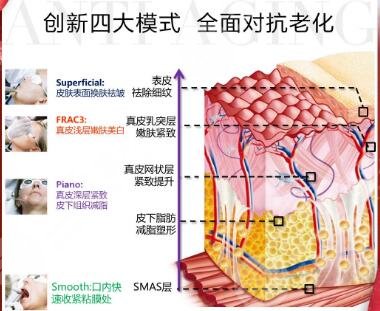 济南欧洲之星4d抗衰多久做一次