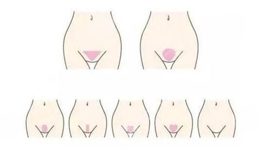 女性比基尼部位脱毛激光原理