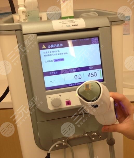 热玛吉手术需要多长时间?