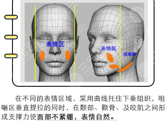 埋线面部提升能维持多久